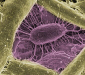 Magnified view of microbes.