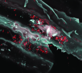 Clostridium thermocellum