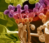 Multicolored magnification view of roots.