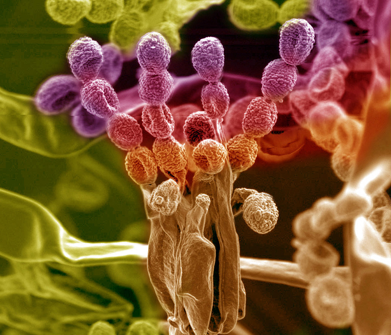 Multicolored magnification view of roots.